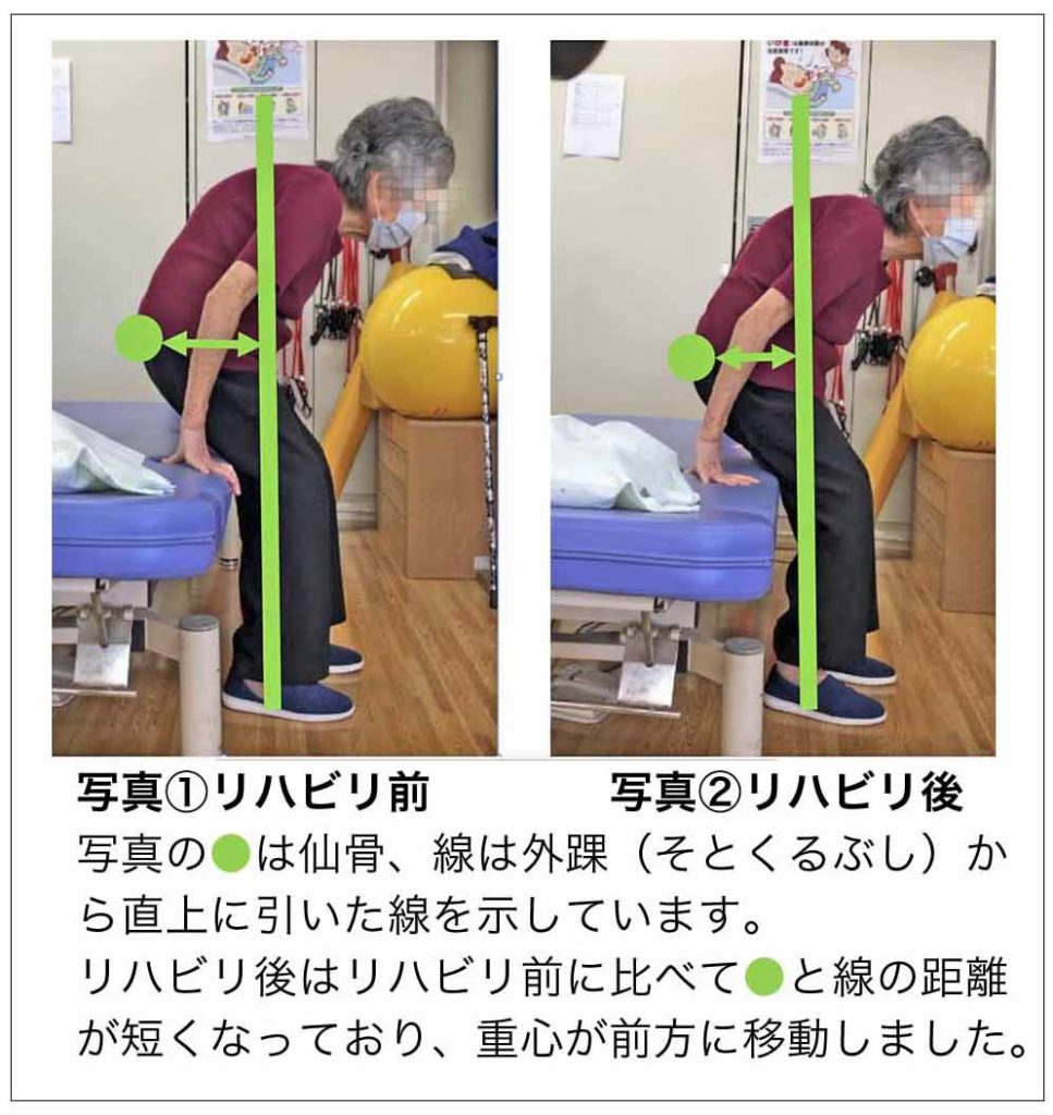 理学療法士のリハビリ記録 カルテ ７ 足腰を鍛えることで手首の痛みが改善 G様 Now From Clinic